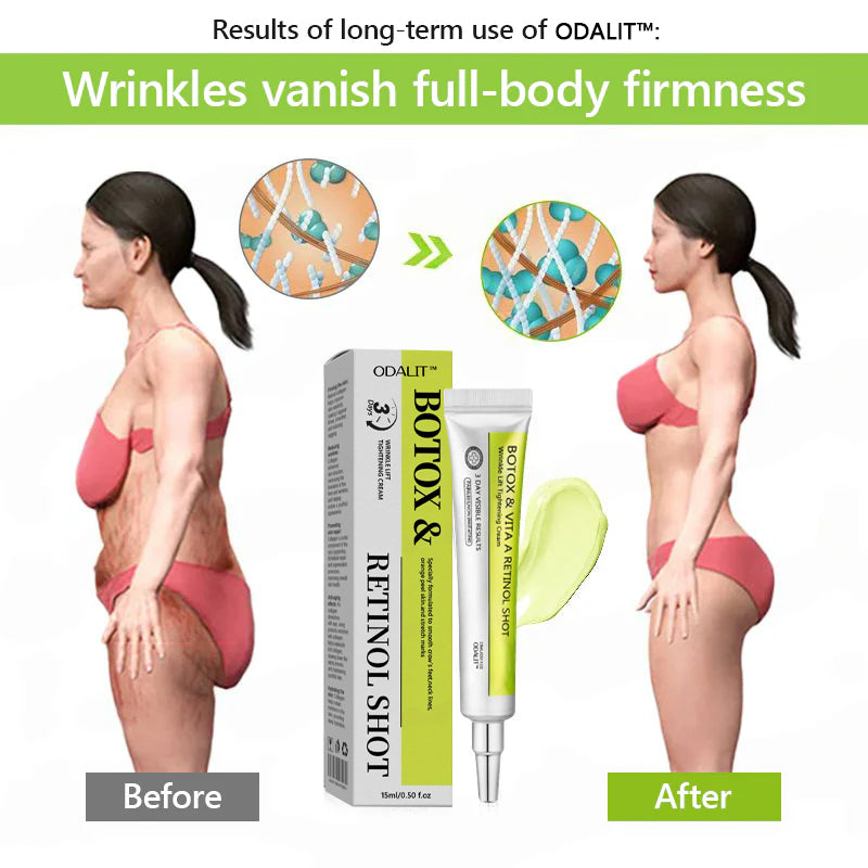 [🔥Laatste dag 70% korting] ODALIT™ Botox- en Retinol-shot - Verwijderaar voor diepe rimpels, doorhangende kaaklijn en opgezwollen ogen