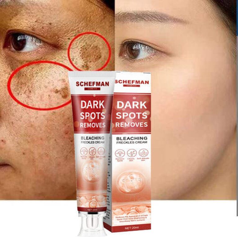 Bruine vlekken Verwijderen | Sproet Creme | Pigmentvlekken Verwijderaar