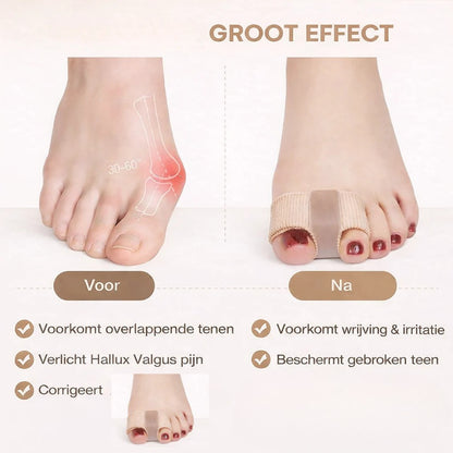 Teenspreider & Bunion Corrector🦶
