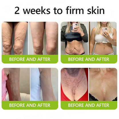 [🔥Laatste dag 70% korting] ODALIT™ Botox- en Retinol-shot - Verwijderaar voor diepe rimpels, doorhangende kaaklijn en opgezwollen ogen