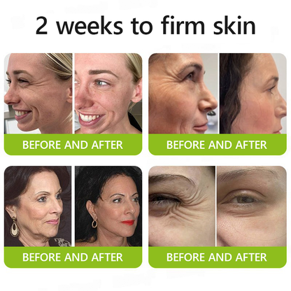 [🔥Laatste dag 70% korting] ODALIT™ Botox- en Retinol-shot - Verwijderaar voor diepe rimpels, doorhangende kaaklijn en opgezwollen ogen