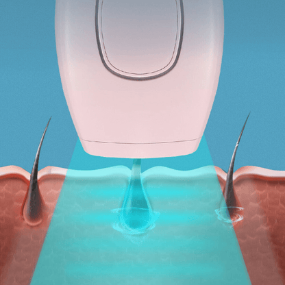 GlowPro IPL Laser Gezichts- en Lichaamsbeharing Handapparaat