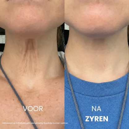 Zyren® halscrèmes voor strakker en lifter