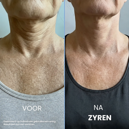 Zyren® halscrèmes voor strakker en lifter